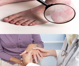 Bệnh vảy phấn hống nảy sinh do đâu