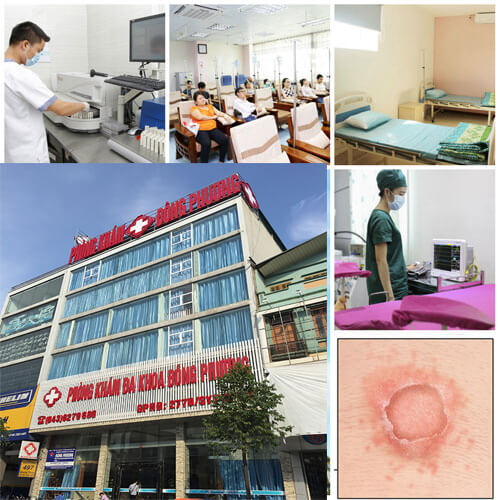 Bệnh vảy phấn hống nảy sinh do đâu