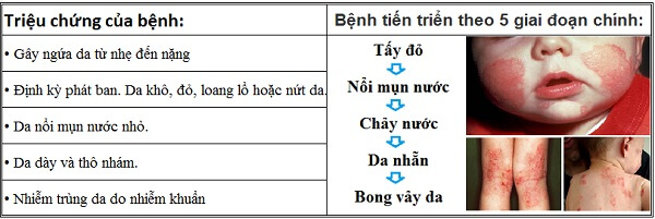 phac do cham da.jpg