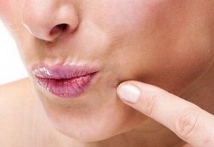 Tác hại do mụn cơm gây ra
